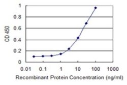 PANK4 Antibody (3C1), Novus Biologicals 0.1 mg | Buy Online | Novus Biologicals | Fisher Scientific