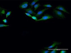 PANK4 Antibody, Novus Biologicals 0.1 mg | Buy Online | Novus Biologicals | Fisher Scientific