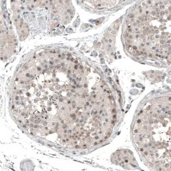 PAPD5 Antibody, Novus Biologicals 25 &mu;L | Buy Online | Novus Biologicals | Fisher Scientific