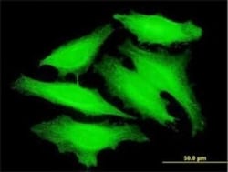 PAPOLB Antibody (3D7), Novus Biologicals 0.1 mg | Buy Online | Novus Biologicals | Fisher Scientific