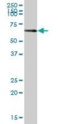 PAPSS2 Antibody, Novus Biologicals 0.05 mg | Buy Online | Novus Biologicals | Fisher Scientific