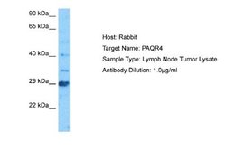 PAQR4 Rabbit anti-Human, Polyclonal, Novus Biologicals 0.1 mL | Buy Online | Novus Biologicals | Fisher Scientific