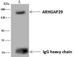 PARG1 Antibody, Novus Biologicals:Antibodies:Primary Antibodies