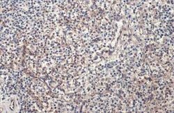 PARP14 Antibody, Novus Biologicals 100 &mu;g | Buy Online | Novus Biologicals | Fisher Scientific
