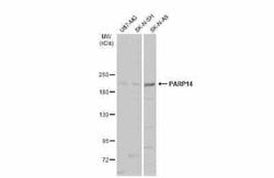 PARP14 Antibody, Novus Biologicals 100 &mu;g | Buy Online | Novus Biologicals | Fisher Scientific
