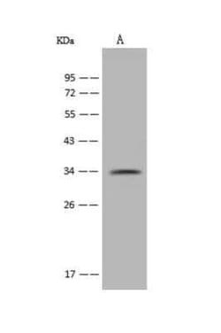PARP16 Antibody, Novus Biologicals:Antibodies:Primary Antibodies