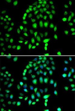 PARP3 Antibody - BSA Free, Novus Biologicals 0.1 mL, Unconjugated:Antibodies,