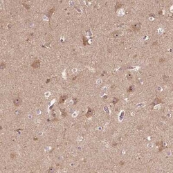 PARP3 Antibody, Novus Biologicals:Antibodies:Primary Antibodies