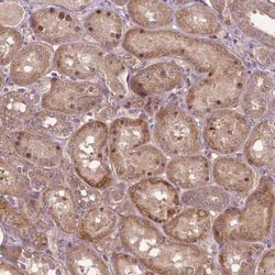 PARP3 Antibody, Novus Biologicals:Antibodies:Primary Antibodies