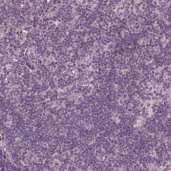 PARP3 Antibody, Novus Biologicals:Antibodies:Primary Antibodies