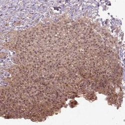 PARP3 Antibody, Novus Biologicals:Antibodies:Primary Antibodies