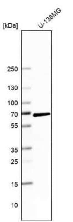 PARP3 Antibody, Novus Biologicals:Antibodies:Primary Antibodies