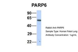 PARP6 Rabbit anti-Human, Polyclonal, Novus Biologicals 0.1 mL | Buy Online | Novus Biologicals | Fisher Scientific