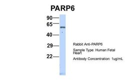 PARP6 Rabbit anti-Human, Polyclonal, Novus Biologicals 0.1 mL | Buy Online | Novus Biologicals | Fisher Scientific