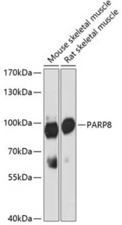 PARP8 Antibody - Azide and BSA Free, Novus Biologicals:Antibodies:Primary