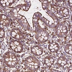 PATJ Antibody, Novus Biologicals:Antibodies:Primary Antibodies