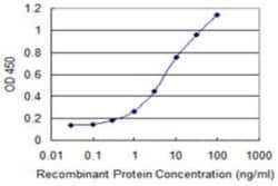 PATZ Antibody (1B2), Novus Biologicals 0.1 mg | Buy Online | Novus Biologicals | Fisher Scientific