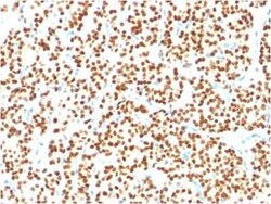 PAX8 Antibody (PAX8/1491), Novus Biologicals 20&mu;g; Unlabeled:Antibodies,