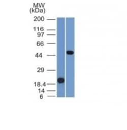 PAX8 Antibody (PAX8/1491), Novus Biologicals 20&mu;g; Unlabeled:Antibodies,
