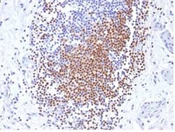 PAX8 Antibody (PAX8/1492), Novus Biologicals 100&mu;g; Unlabeled:Antibodies,