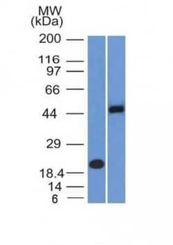 PAX8 Antibody (PAX8/1492), Novus Biologicals 100&mu;g; Unlabeled:Antibodies,
