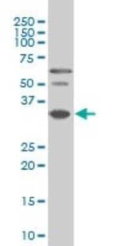 PAX9 Antibody (4B9), Novus Biologicals 0.1 mg | Buy Online | Novus Biologicals | Fisher Scientific