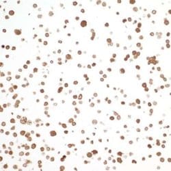 PBEF/Visfatin/NAMPT Antibody (BLR058F), Novus Biologicals 100 &mu;L | Buy Online | Novus Biologicals | Fisher Scientific