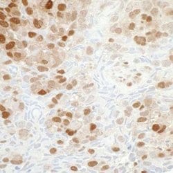 PBEF/Visfatin/NAMPT Antibody (BLR058F), Novus Biologicals 100 &mu;L | Buy Online | Novus Biologicals | Fisher Scientific