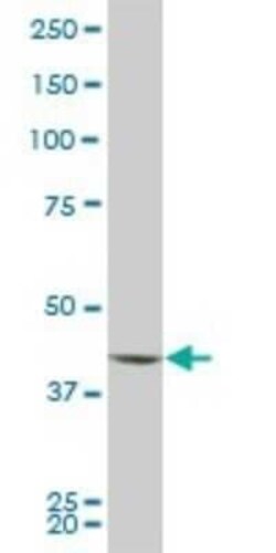 PBK Antibody (2D6), Novus Biologicals 0.1 mg | Buy Online | Novus Biologicals | Fisher Scientific