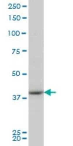 PBK Antibody (2D6), Novus Biologicals 0.1 mg | Buy Online | Novus Biologicals | Fisher Scientific