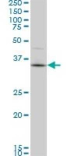 PBK Antibody (3A7), Novus Biologicals 0.1 mg | Buy Online | Novus Biologicals | Fisher Scientific