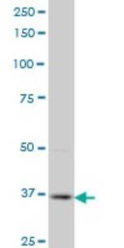 PBK Antibody (3A7), Novus Biologicals 0.1 mg | Buy Online | Novus Biologicals | Fisher Scientific