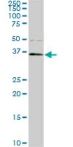 PBK Antibody (3A7), Novus Biologicals 0.1 mg | Buy Online | Novus Biologicals | Fisher Scientific
