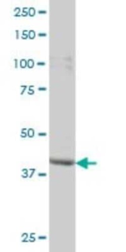 Novus Biologicals PBK Antibody (3F7), Novus Biologicals 0.1 mg | Buy Online | Novus Biologicals&trade; | Fisher Scientific