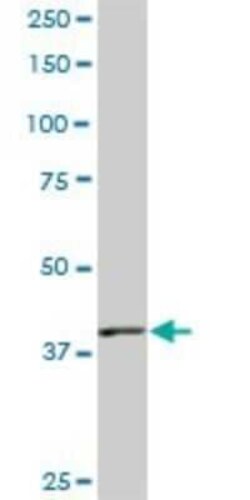 Novus Biologicals PBK Antibody (3F7), Novus Biologicals 0.1 mg | Buy Online | Novus Biologicals&trade; | Fisher Scientific