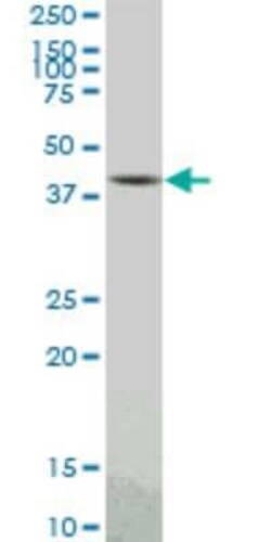 Novus Biologicals PBK Antibody (3F7), Novus Biologicals 0.1 mg | Buy Online | Novus Biologicals&trade; | Fisher Scientific