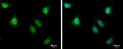 PBK Antibody, Novus Biologicals 100 &mu;g | Buy Online | Bio-Techne | Fisher Scientific