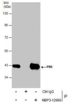 PBK Antibody, Novus Biologicals 100 &mu;g | Buy Online | Bio-Techne | Fisher Scientific