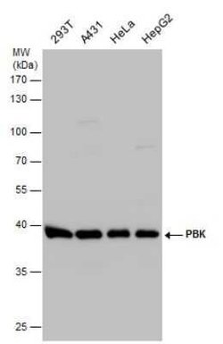 PBK Antibody, Novus Biologicals 100 &mu;g | Buy Online | Bio-Techne | Fisher Scientific