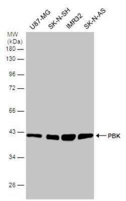 PBK Antibody, Novus Biologicals 100 &mu;g | Buy Online | Bio-Techne | Fisher Scientific