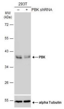 PBK Antibody, Novus Biologicals 100 &mu;g | Buy Online | Bio-Techne | Fisher Scientific