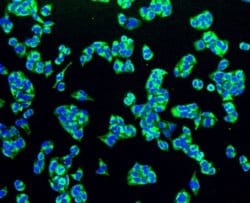 PBR Rabbit anti-Human, Clone: SA90-03, Novus Biologicals 100&mu;L:Antibodies,