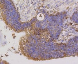 PBR Rabbit anti-Human, Clone: SA90-03, Novus Biologicals 100&mu;L:Antibodies,