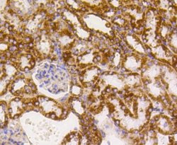 PBR Rabbit anti-Human, Clone: SA90-03, Novus Biologicals 100&mu;L:Antibodies,