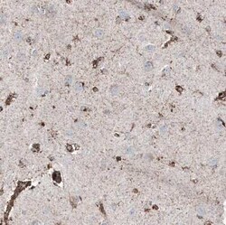 PBR Antibody (CL13358), Novus Biologicals 25 &mu;g; Unconjugated:Antibodies,
