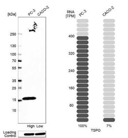 PBR Antibody (CL13359), Novus Biologicals:Antibodies:Primary Antibodies