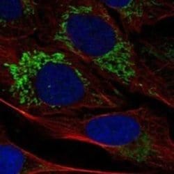 PBR Rabbit anti-Human, Polyclonal, Novus Biologicals 100 &mu;g; Unconjugated:Antibodies,