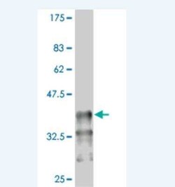 PBX1 Antibody (2D6), Novus Biologicals 0.1 mg | Buy Online | Novus Biologicals | Fisher Scientific
