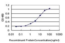 PBX1 Antibody (3F7), Novus Biologicals 0.1 mg | Buy Online | Novus Biologicals | Fisher Scientific
