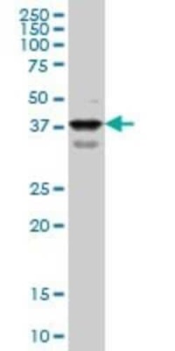 PBX1 Antibody (3F7), Novus Biologicals 0.1 mg | Buy Online | Novus Biologicals | Fisher Scientific